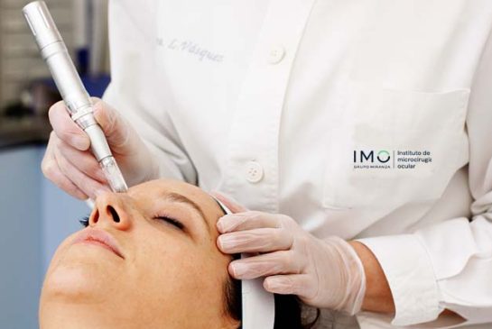 dermapen_microneedling_0